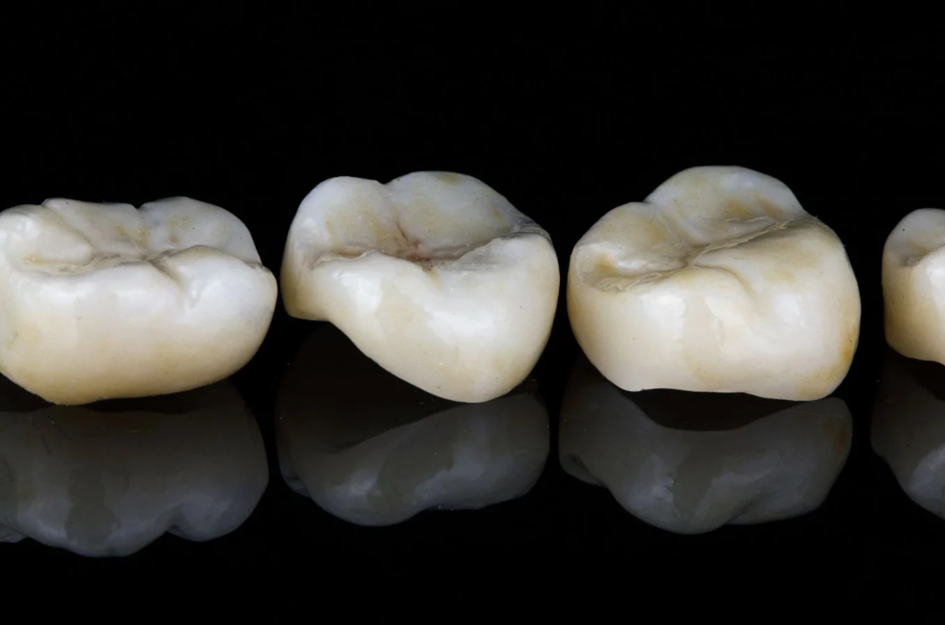 Dental Crowns