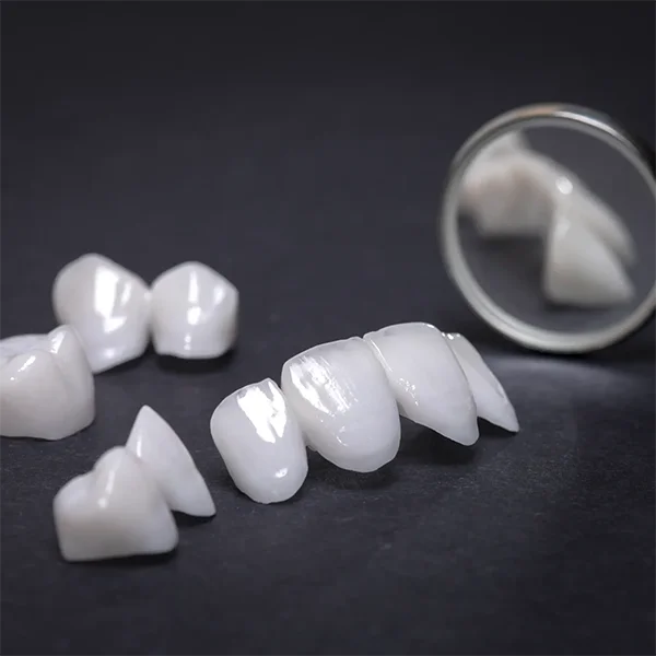 Set of Porcelain Veneers