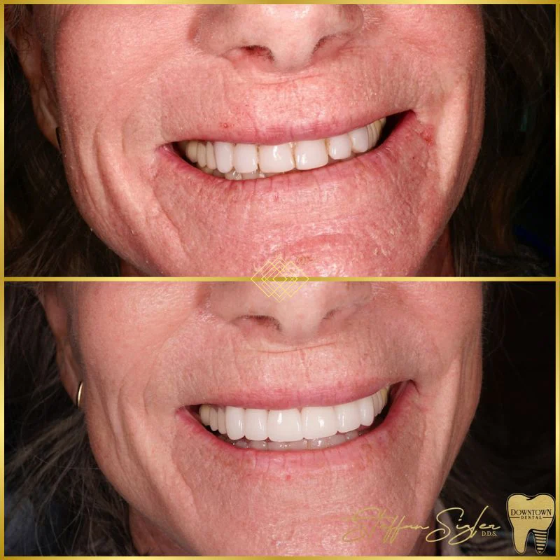 Downtown Dental Patient Before and After